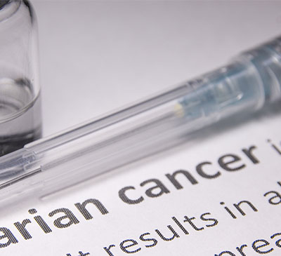 Global Ovarian Cancer Drugs Market 2019-2023